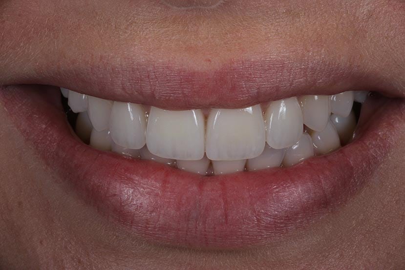 Best Cosmetic Dentist Jupiter, FL Palm Beach Gardens Cosmetic