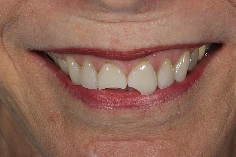 Best Cosmetic Dentist Jupiter, FL Palm Beach Gardens Cosmetic