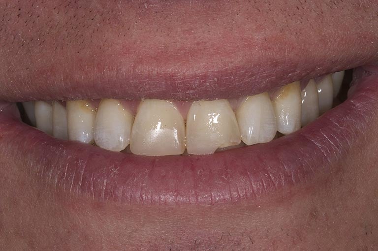 Best Cosmetic Dentist Jupiter, FL Palm Beach Gardens Cosmetic