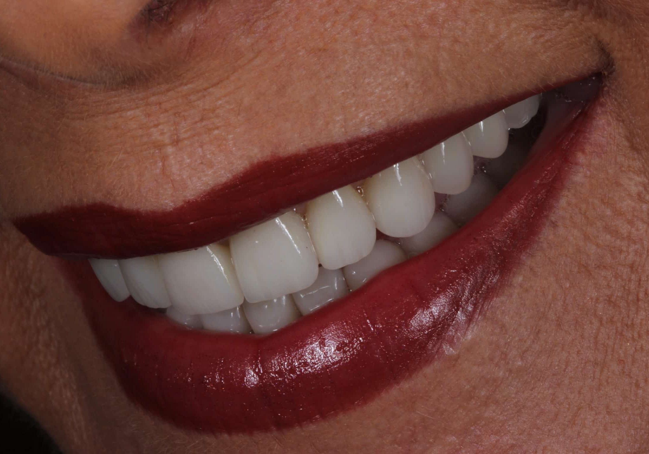 Close-up of a smiling mouth with bright red lipstick and white teeth visible along the upper row.